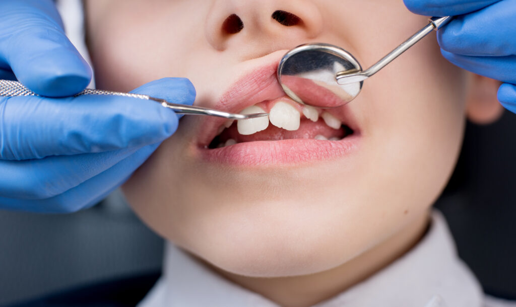 Emergency Dentistry in Thousand Oaks 