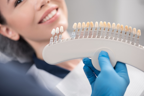 Customize Your Porcelain Veneers