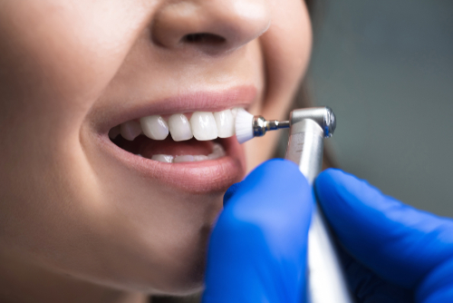 Everything That Happens During a Teeth Cleaning