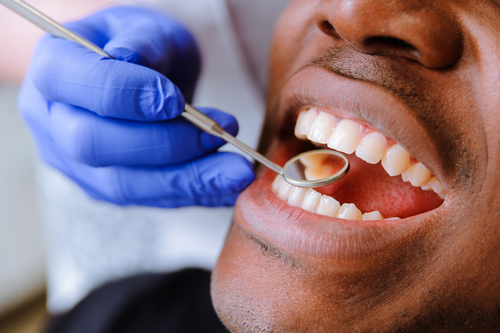 Cost Factors of a Teeth Cleaning 