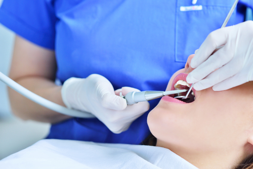 What to Expect from Gum Disease Treatment