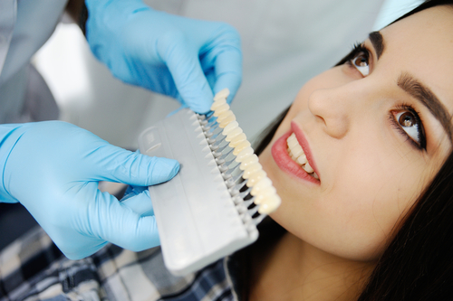 Tooth-Colored Fillings